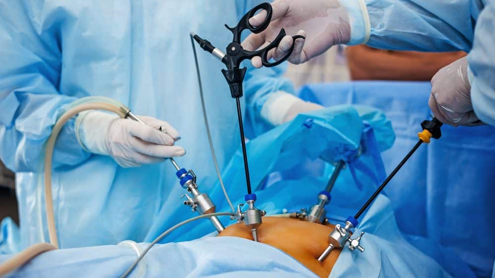 Cirurgia de vesícula: como é feita e como é a recuperação | Cirurgia de  Hérnia e Vesícula Biliar em Curitiba